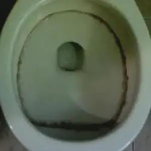 how to get rid of black mold on toilet seat